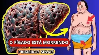 Seu fígado está morrendo? 12 sintomas críticos que você deve conhecer!
