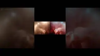 ЧАТ РУЛЕТКА ПРИКОЛЫ НАД ЛЮДЬМИ  #shorts
