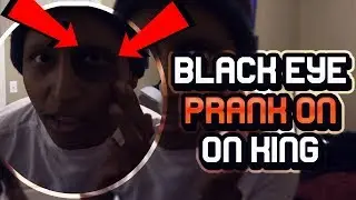 Black eye PRANK w/Funnymike on King FROM NIQUE AND KING