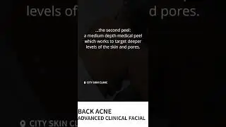 Advanced clinical facial for back acne, scars & hyperpigmentation 🙌🤩✨ #skincare #beauty #acne