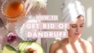 How to Get Rid of Dandruff | Home Remedies