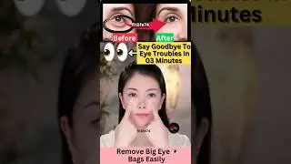 Say Goodbye To Eye Troubles In 03 Minutes #eyelift #eyeexercise #yoga #faceyoga #facialyoga  #shorts