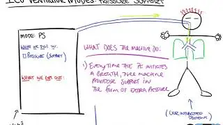 Pressure Support