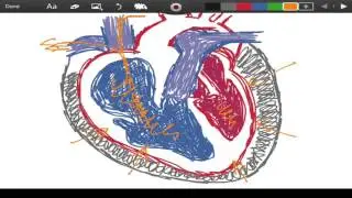 Beck's Triad - Cardiac Tamponade - EMTprep.com