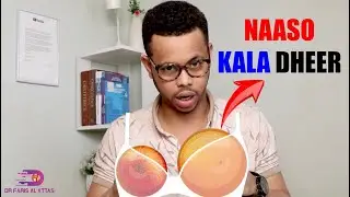 CILDAHA  NAASAHA DUMRKA