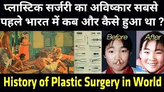 भारत में पहली बार कब और कहाँ हुई थी प्लास्टिक सर्जरी ? First Plastic Surgery In India
