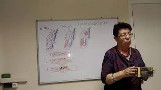 Тромбофлебит. Лекция Михайловой Р. И.