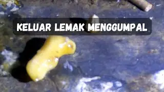 GAK SENGAJA KELUARIN LEMAK DARI BETINA TUA, BEGINI CARANYA