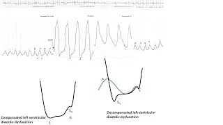 Hemodynamics 1: Essential hemodynamics, pitfalls, anomalies- Elias Hanna, Univ Iowa
