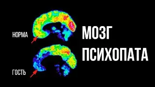 ПСИХОПАТИЯ/Социопатия: нейробиология и разговор с пациентом