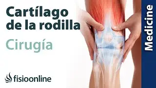 CIRUGÍA del CARTÍLAGO de la RODILLA