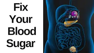 Blood Sugar - 4 Surprisingly Unhealthy 