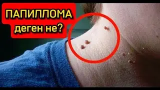ПАПИЛЛОМА деген не? Тері өсінділері. Сүйел. Денсаулық арнасы. Денсаулық
