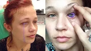 LA TERRIBLE EXPERIENCIA DE UNA MODELO AL TATUARSE EL OJO