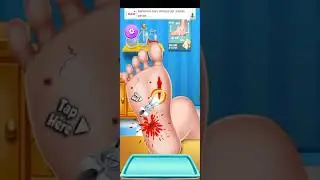 dokter membersihkan kaki yang luka dan infeksi||games anak