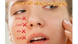 علاح البشره المتحسسه الجافه