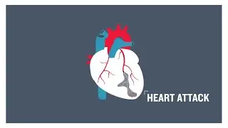 Heart attack, clogged arteries and atherosclerosis