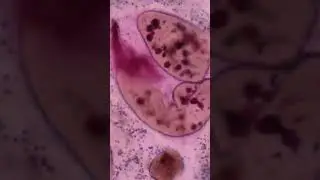 Paramecia in amoeba food vacuole #shorts