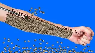 ASMR Treatment 2D Animation | Dog Ticks Infected Hand | @HealAsmr914K