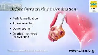 Intrauterine Insemination  - CIMS Hospital