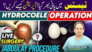 Hydrocoele Operation | Jaboulay Procedure ( Hydrocoelectomy) | Surgeon Dr Imtiaz Hussain