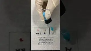 Como o laboratório descobre seu tipo de sangue 