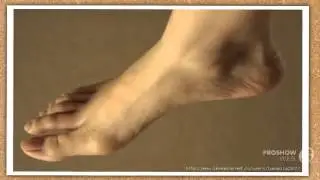 как исправить косточку на ноге

  - Корректор большого пальца Valgus Pro