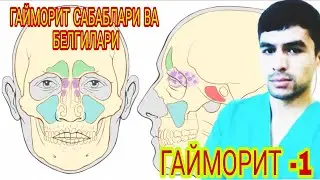 ГАЙМОРИТ БУ НИМА?? БЕЛГИЛАРИ ВА ДАВОЛАШ ЮЛЛАРИ!!!