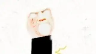 bad animation