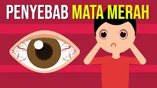 What Causes Red Eyes?