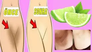 With this cream, I don't have any unwanted hair and spots problem, lemon cream recipe.!