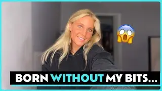 I Was Born Without My Bits 😳 | STORYTRENDER