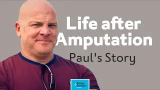 Paul's Story: Life After Amputation