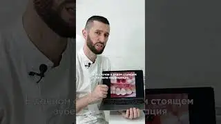 Дентальная имплантация КЕЙС
