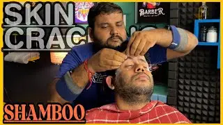 ASMR Loud Skin Crackings | Intense Hair Cracking Head Massage by SHAMBOO💈#asmr