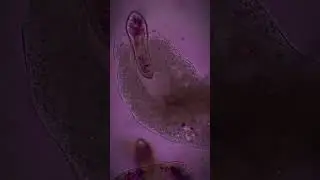 Когда видишь как амёба ест твою туфельку