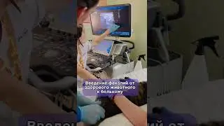 Пересадка какашек