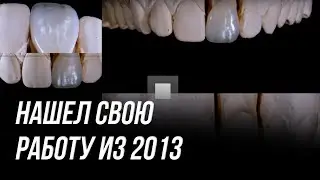 Зубной техник обучение с нуля. Моя работа с 2013 года. Как я научился работать сам зубным техником