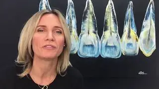 Myth: Invisalign can't move crowded teeth