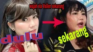 Ada apa dengan wajah via Vallen?