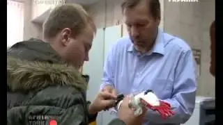 Мальчику распечатали руку на 3D принтере.