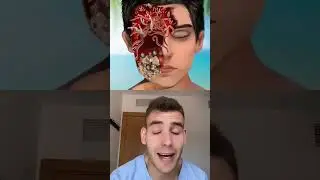 Bad luck 🍀 