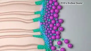 BioSeal Obturation Explained