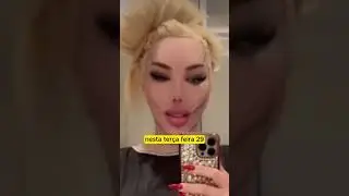 JESSICA ALVES PASSA POR NOVO PROCEDIMENTO E CHAMA