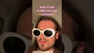 Avoir une calvitie à 17 ans