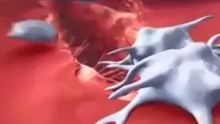 Откуда берутся холестериновые бляшки