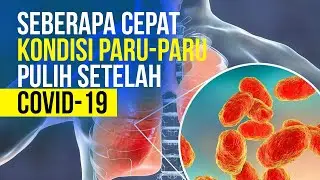 Betulkah Perlu Waktu Kembalikan Kondisi Paru-Paru Setelah Terinfeksi Covid-19?