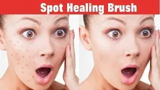 How to Remove pimples with Spot Healing Brush in Photoshop