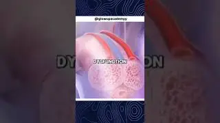 How to get rid of Pornography addiction #shorts