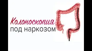 Колоноскопия под наркозом